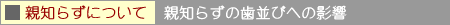�e�m�炸�ɂ���