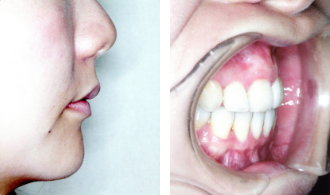 治療後