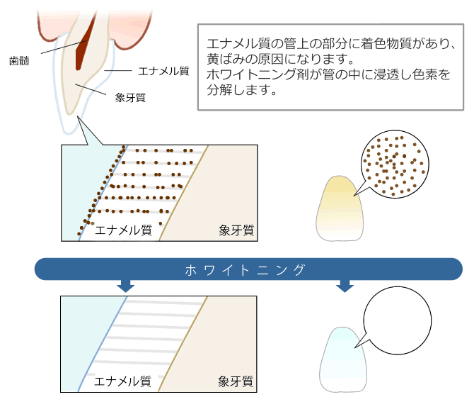 ホワイトニングのしくみ