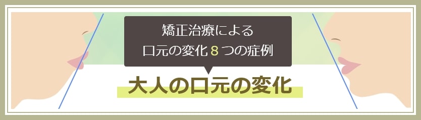 大人の矯正症例ページへ