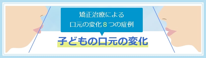 子どもの矯正症例ページへ